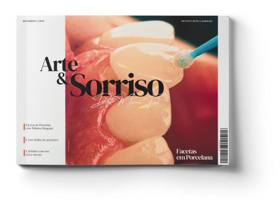 Facetas de porcelana